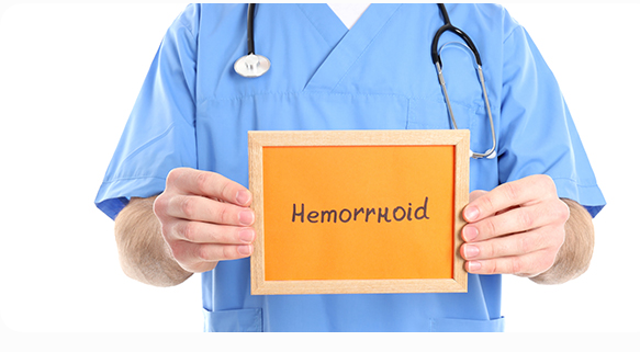 hemorrhoid